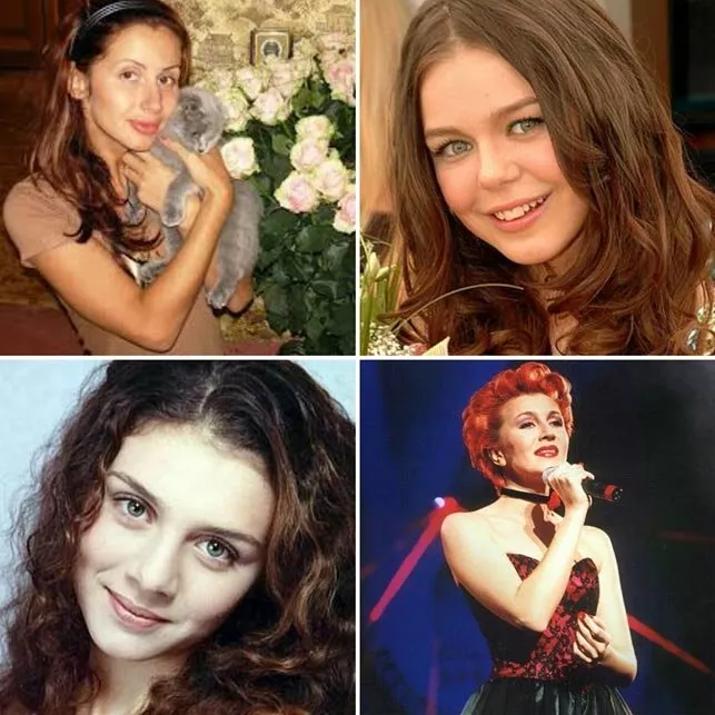 Слепить себя: кто из звезд прибегал к услугам пластических хирургов - 1 - изображение