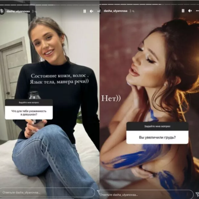Победительница Холостяка Даша Ульянова рассказала о пластических операциях - 2 Победительница Холостяка Даша Ульянова рассказала о пластических операциях - 2 - изображение