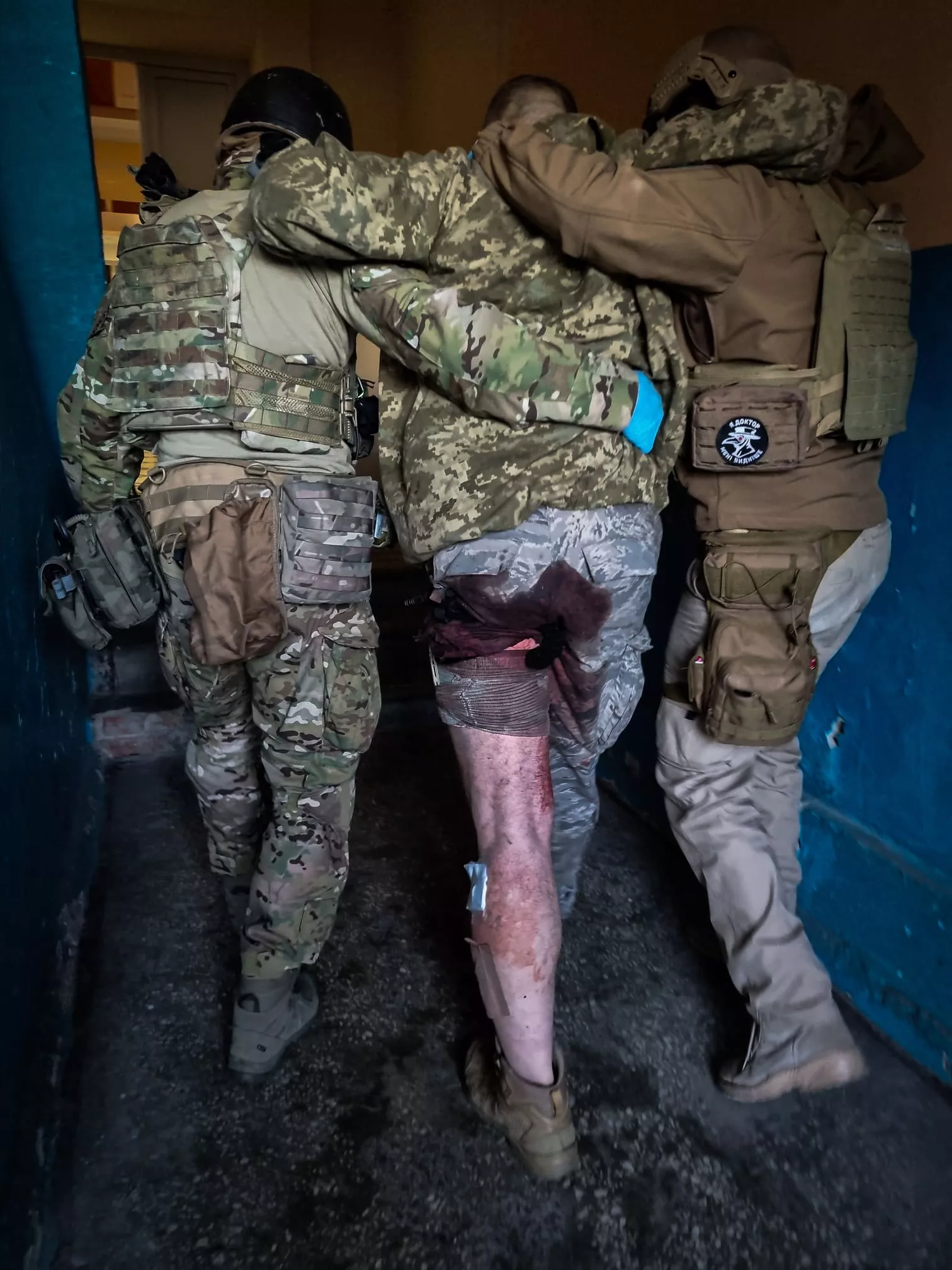 10 000 джгутів-турнікетів для поранених: медбатальйон “Госпітальєри” оголосив збір коштів - 2 10 000 джгутів-турнікетів для поранених: медбатальйон “Госпітальєри” оголосив збір коштів - 2 - изображение